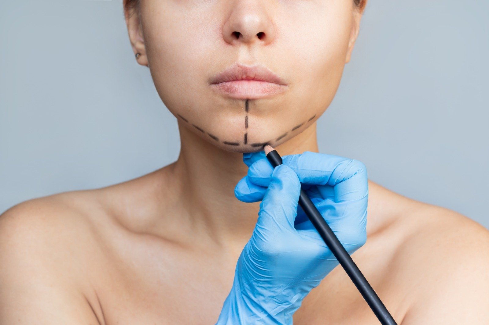 Çene Dolgusu ve Burun Dolgusu: Ameliyatsız Estetik Dokunuşlar